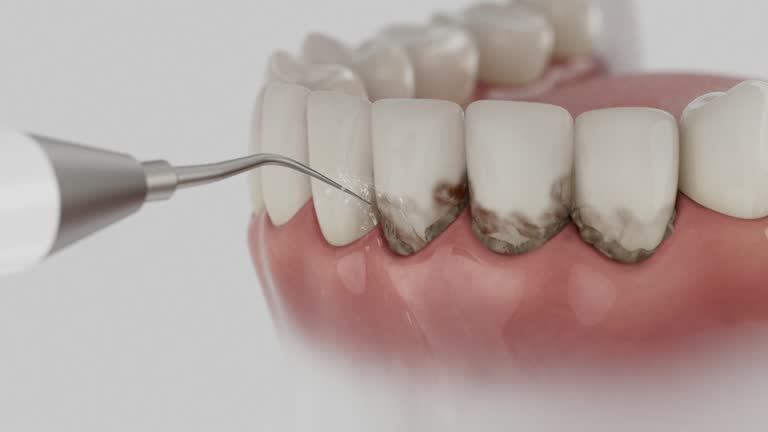 Reliable Emergency Dentist contractor in San Augustine, TX by Smile Center Dentistry